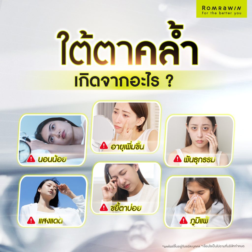 ใต้ตาคล้ำ ทำหน้าโทรมแก้อย่างไร? เช็กสาเหตุ และวิธีแก้ปัญหาใต้ตาคล้ำ 2 ใต้ตาคล้ำเกิดจากอะไร?