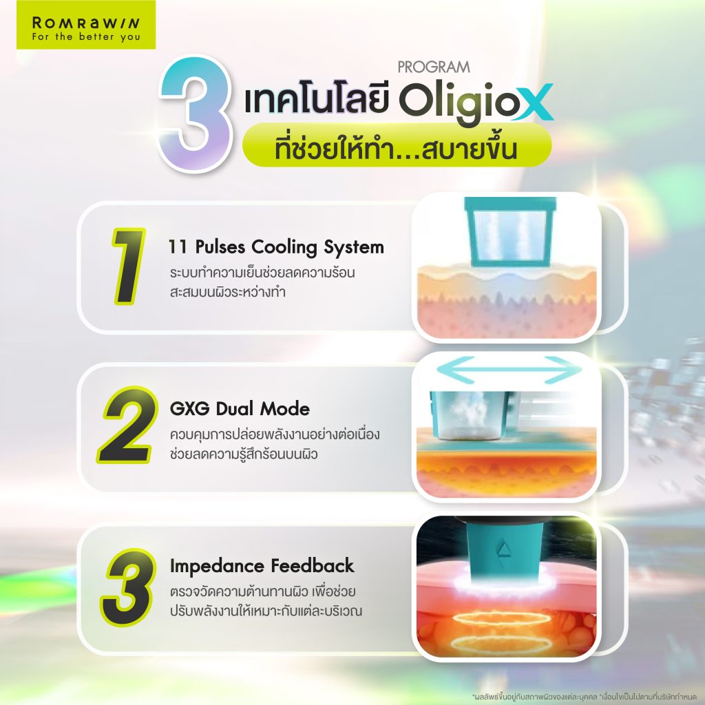 3 เทคโนโลยี Oligio X ที่ช่วยทำให้สบายขึ้น