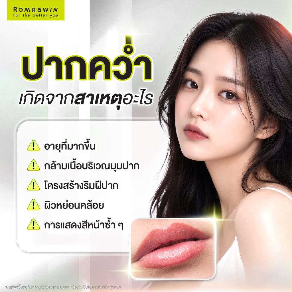 ปากคว่ำเกิดจากอะไร? แก้ไขได้อย่างไร? พร้อมรวมวิธียกมุมปากขึ้น 2 ปากคว่ำเกิดจากสาเหตุอะไร?