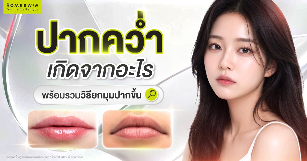 ปากคว่ำเกิดจากอะไร? แก้ไขได้อย่างไร? พร้อมรวมวิธียกมุมปากขึ้น 1 ปากคว่ำ
