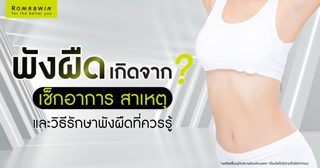 พังผืดเกิดจากอะไร? เช็กอาการ สาเหตุ และวิธีรักษาพังผืดที่ควรรู้ 1 พังผืด