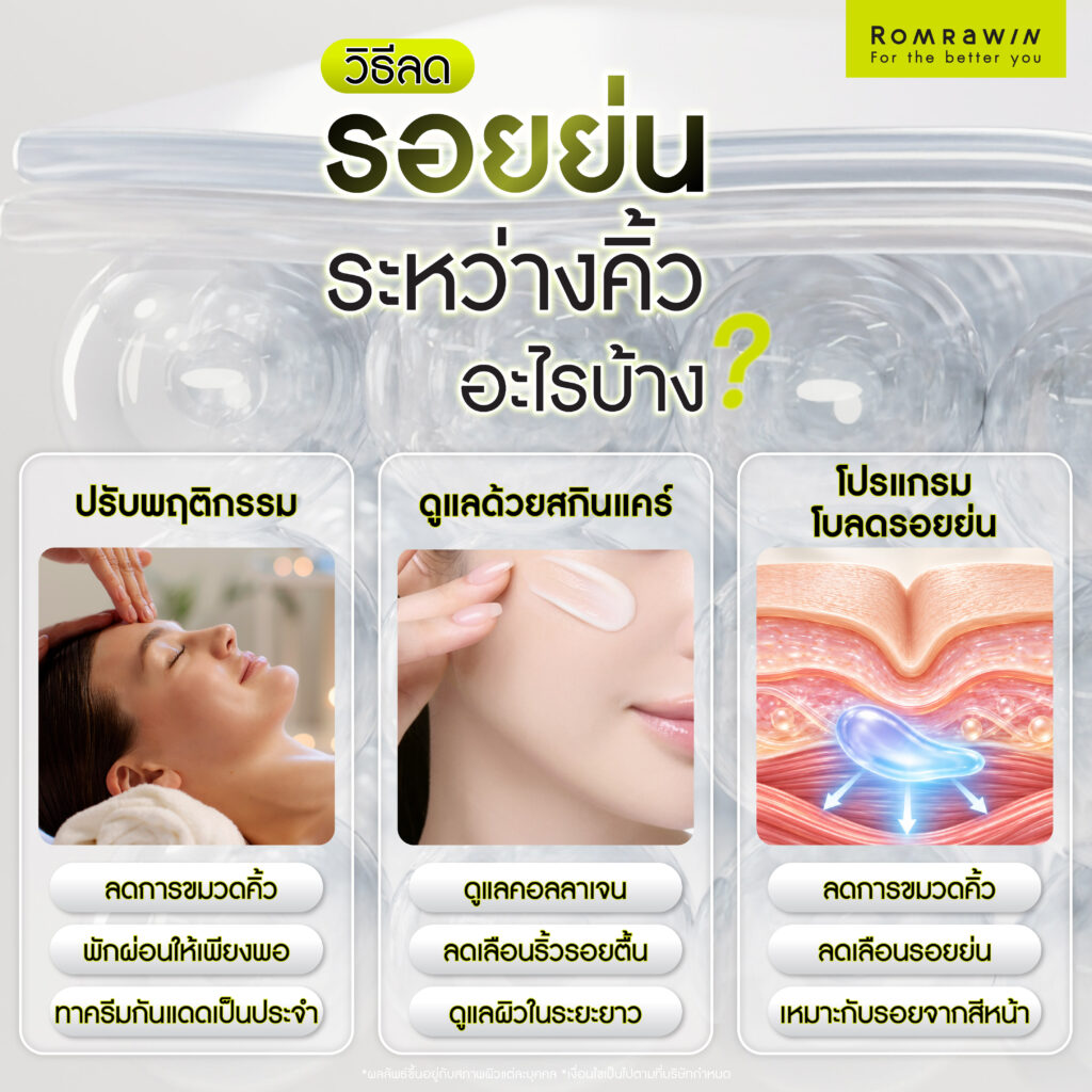 รอยย่นระหว่างคิ้วเกิดจากอะไร? เช็กสาเหตุ พร้อมวิธีลดริ้วรอยให้เหมาะกับแต่ละปัญหา 2 รอยย่นระหว่างคิ้วเกิดจากอะไร?