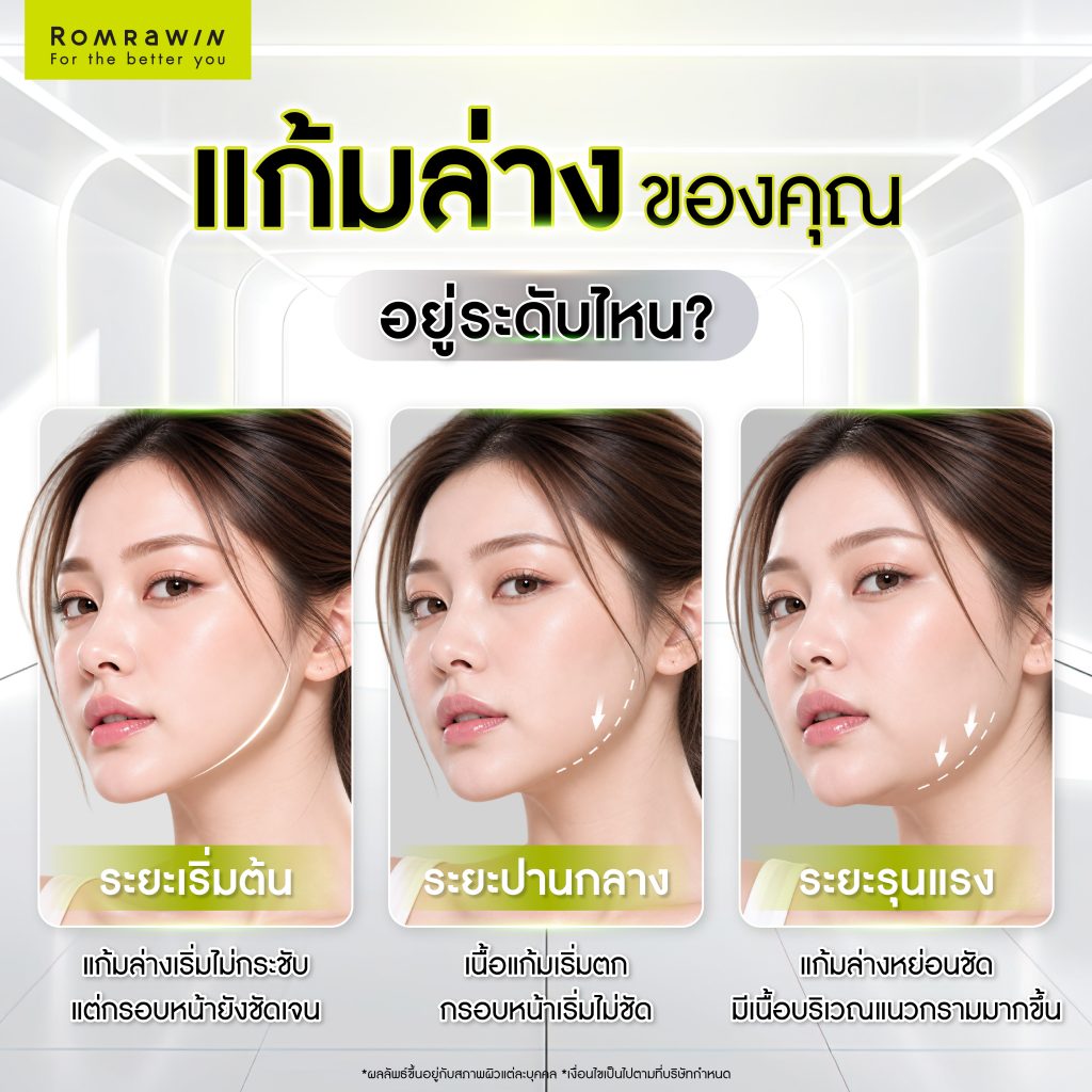 แก้มล่างของคุณอยู่ระดับไหน?