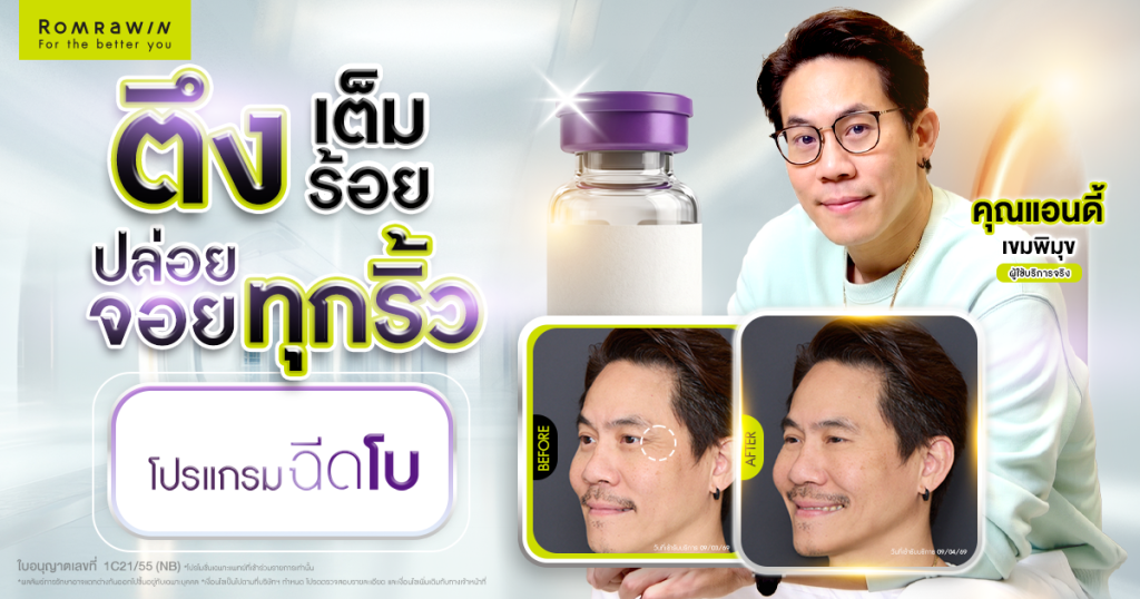 แอนดี้