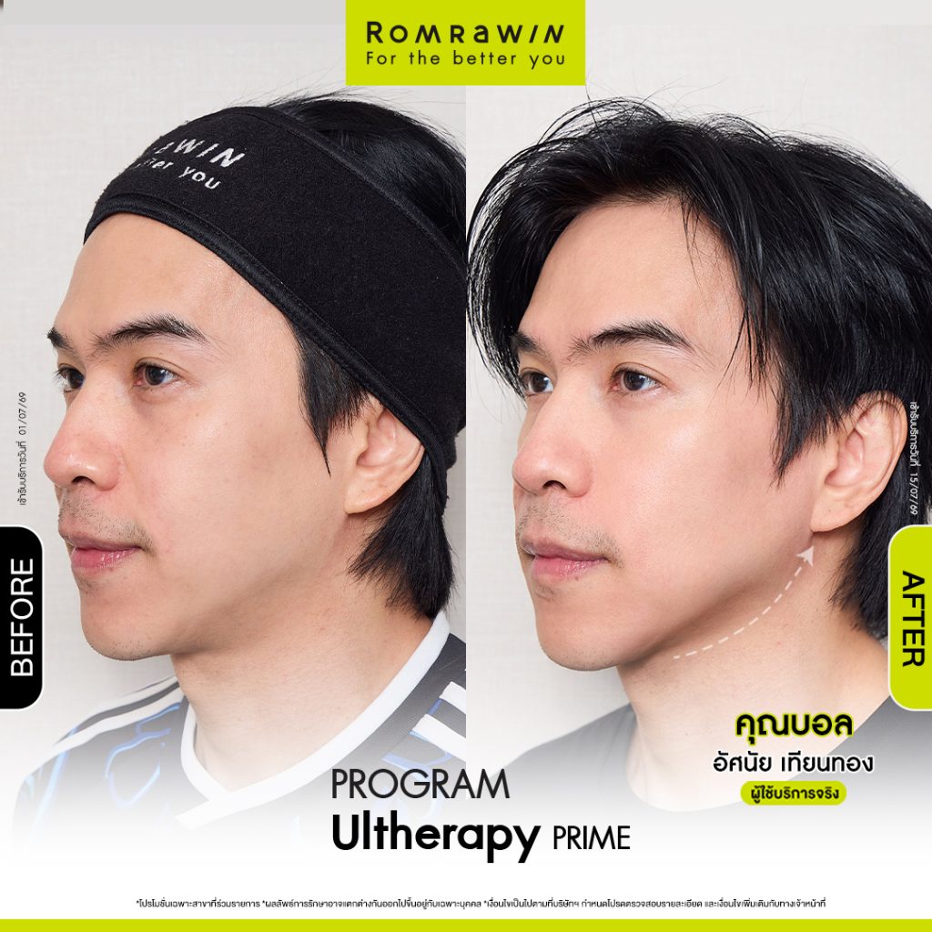 บอล