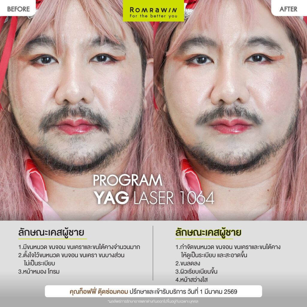 ท็อฟฟี่