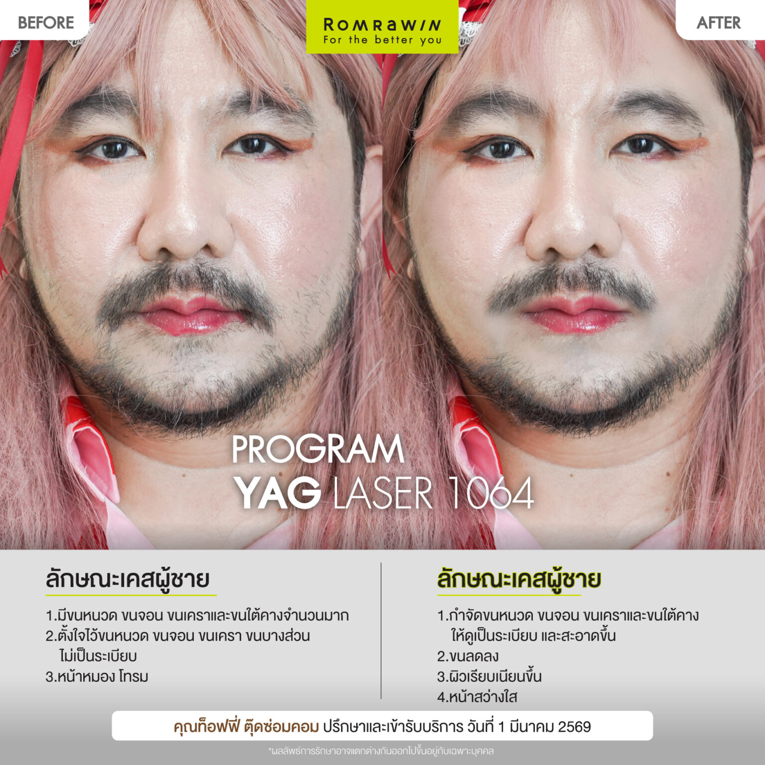 ท็อฟฟี่