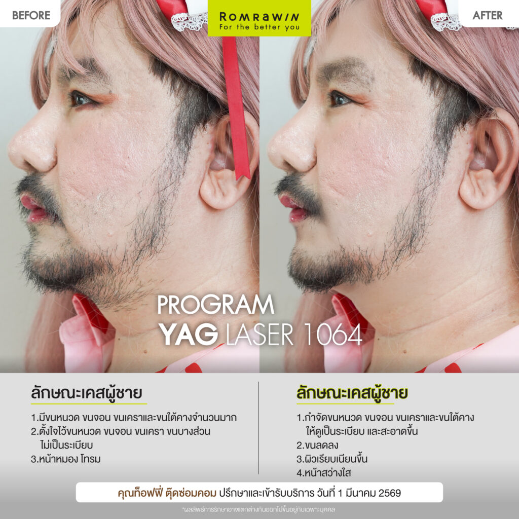 ท็อฟฟี่