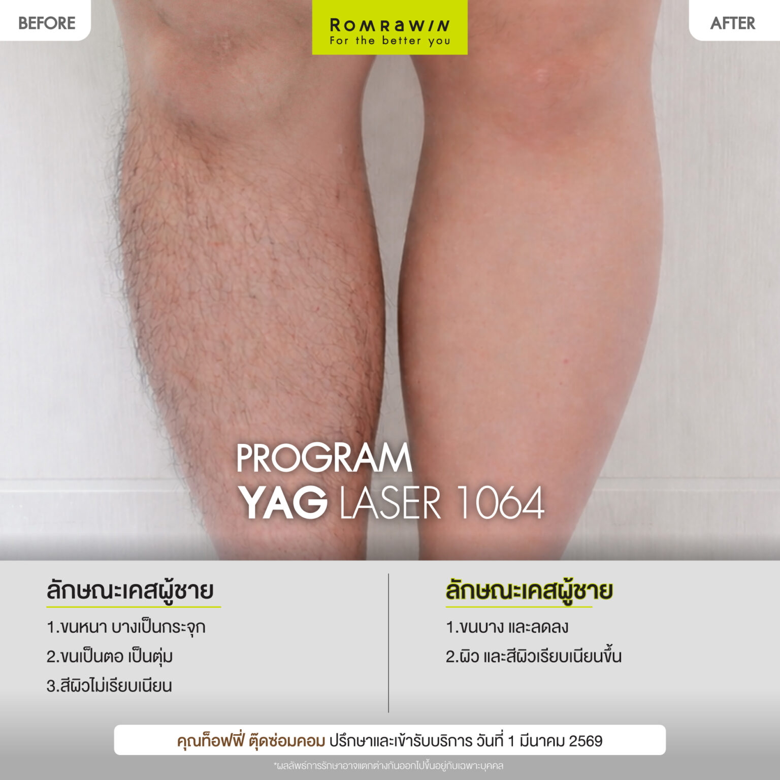 ท็อฟฟี่