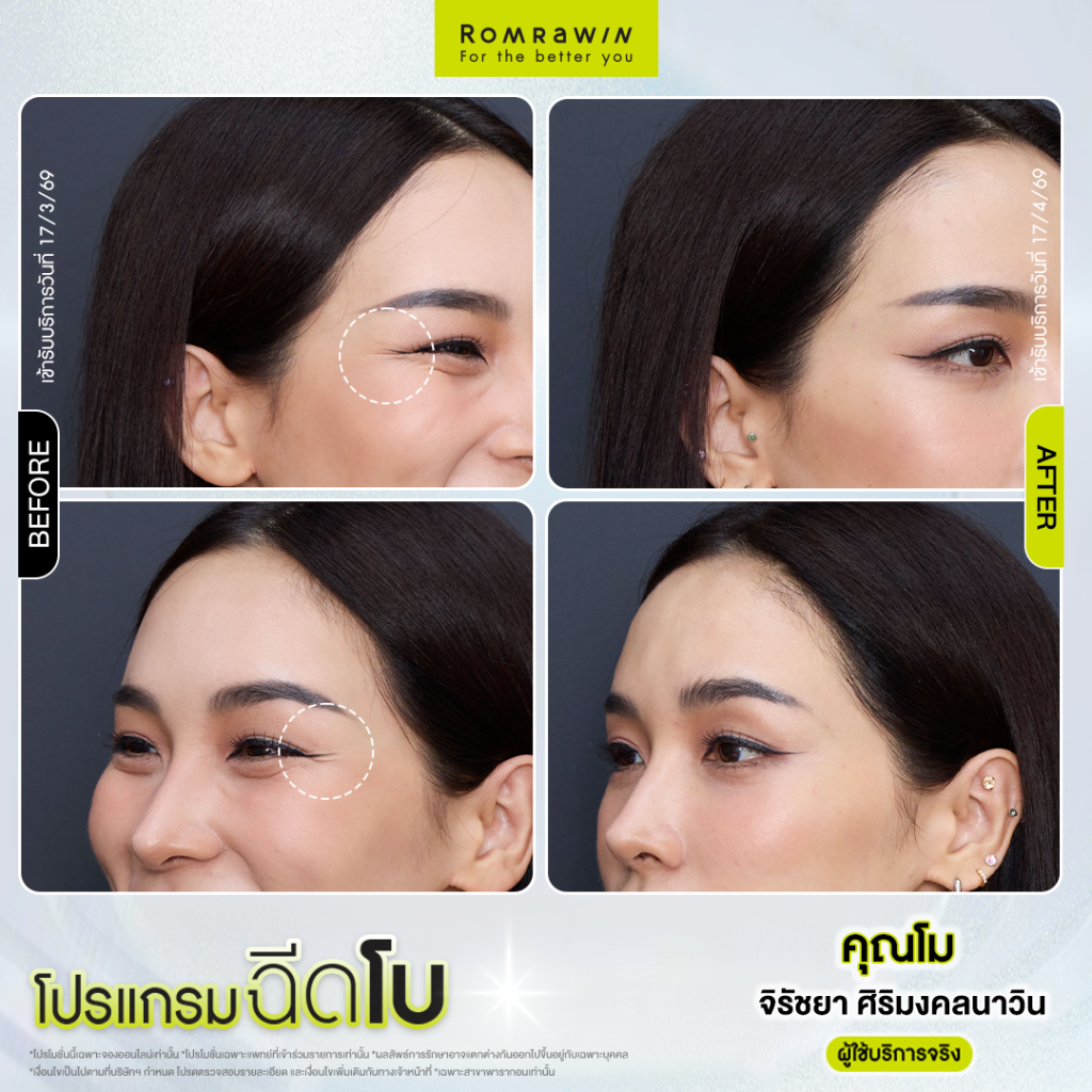 โม