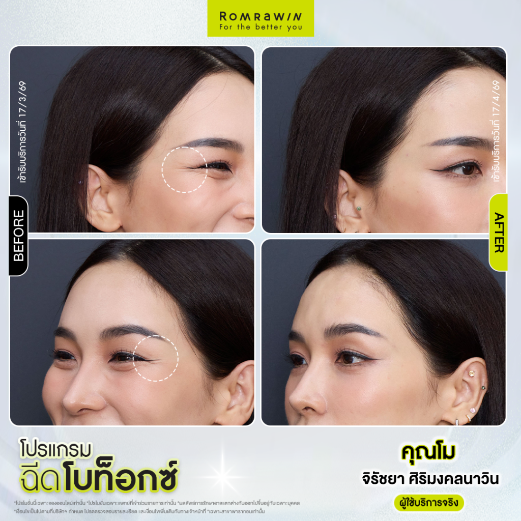 โม