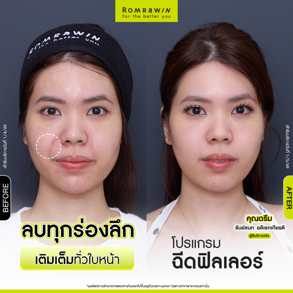 ดรีม