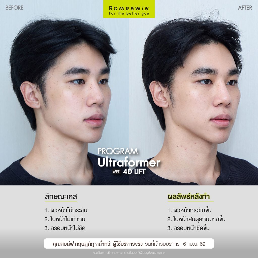 กอล์ฟ
