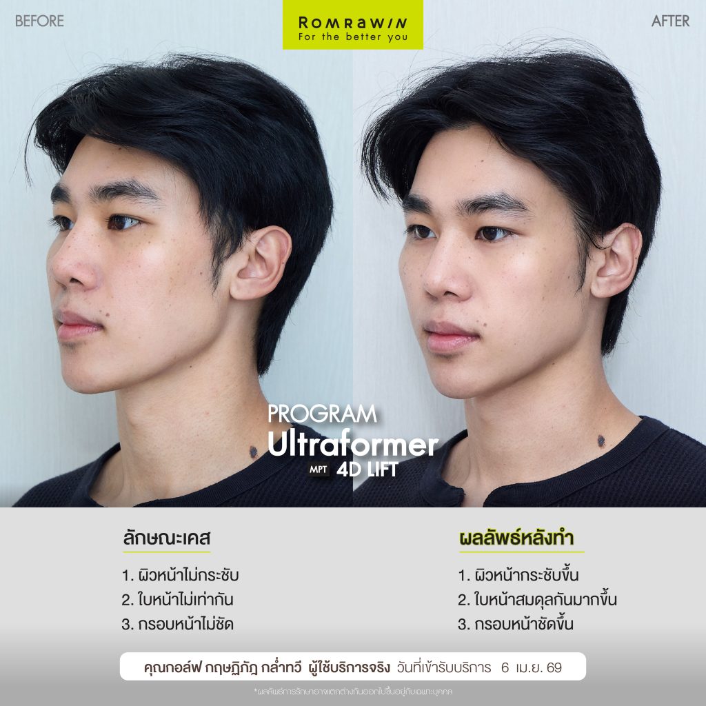 กอล์ฟ