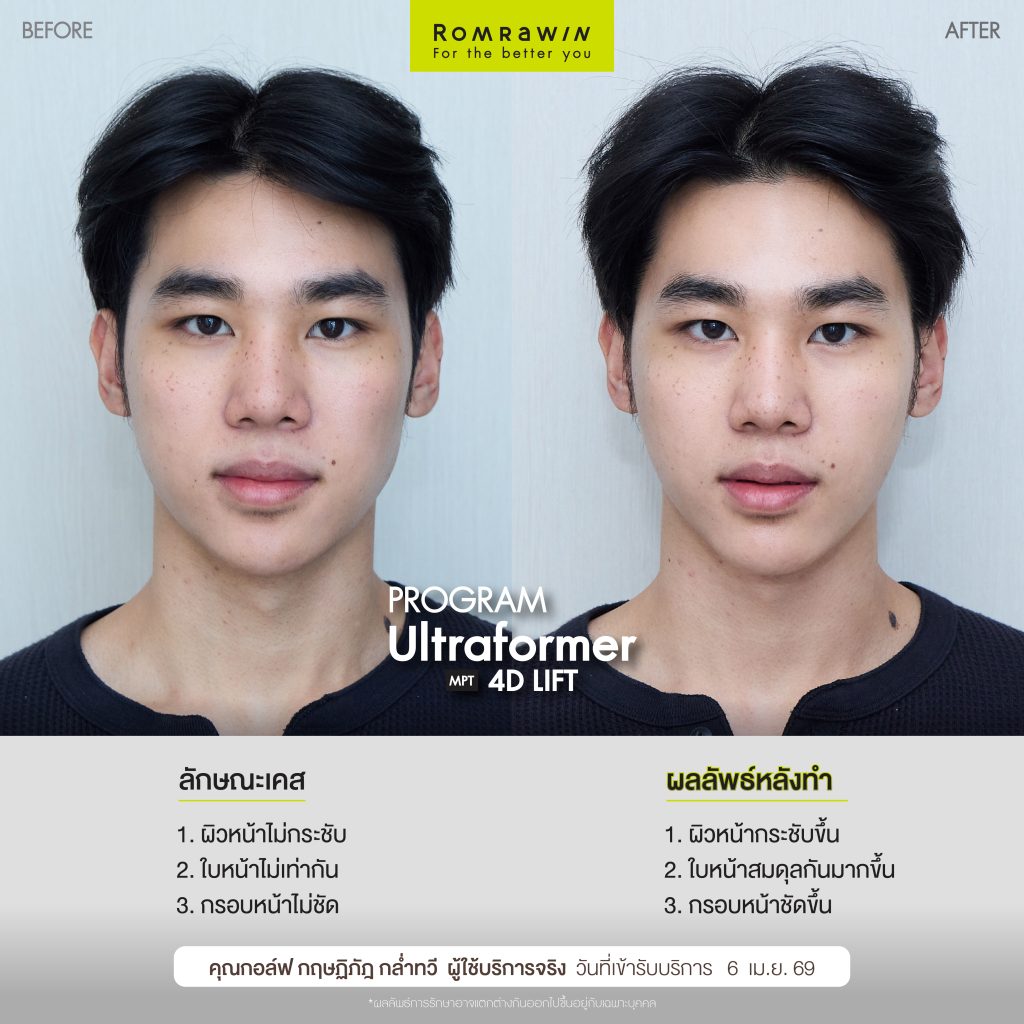 กอล์ฟ