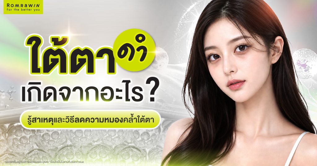 ใต้ตาดำเกิดจากอะไร? รู้ลึกถึงสาเหตุ และวิธีลดความหมองคล้ำใต้ตา 1 ใต้ตาดำ