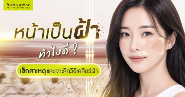 หน้าเป็นฝ้าทำไงดี