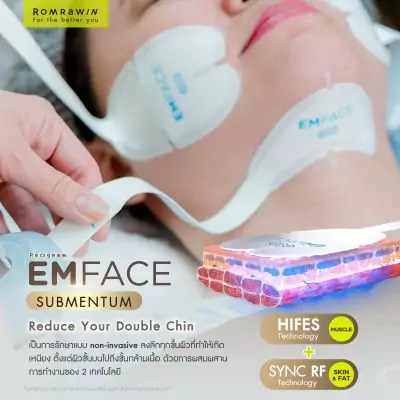 Emface Submentum เก็บเหนียง หน้ายก คืออะไร? เหมาะกับใคร ? 4 Emface Submentum