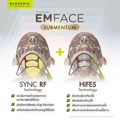 Emface Submentum เก็บเหนียง หน้ายก คืออะไร? เหมาะกับใคร ? 5 Emface Submentum