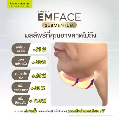 Emface Submentum เก็บเหนียง หน้ายก คืออะไร? เหมาะกับใคร ? 6 Emface Submentum