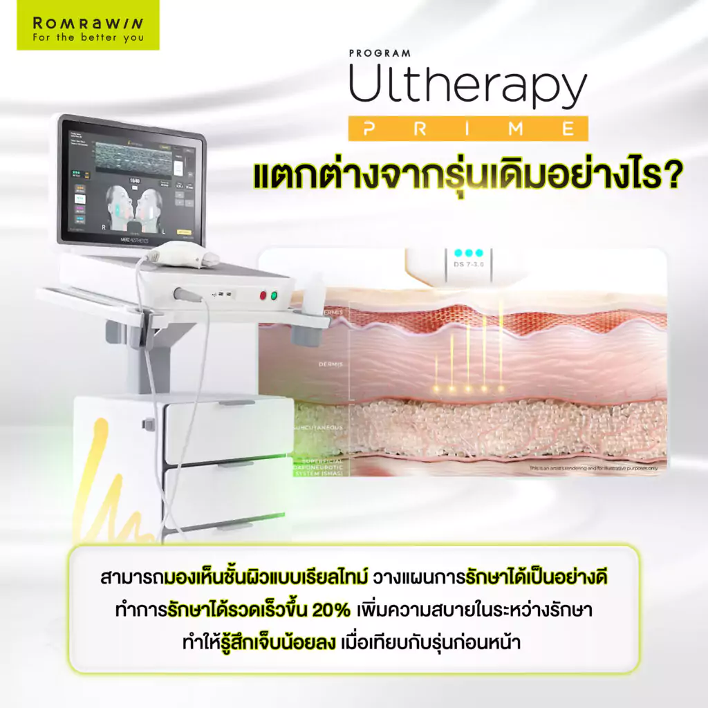 Ulthera Prime แต่ต่างจากรุ่นเดิมอย่างไร