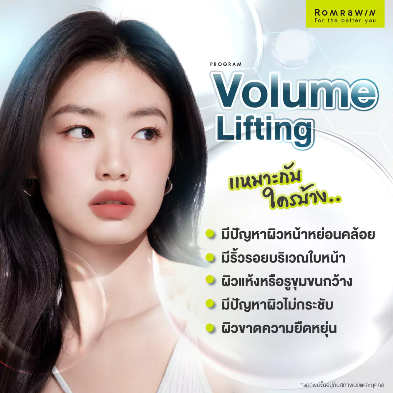 Volume Lifting ยกกระชับผิวหน้าเผยเคล็ดลับผิวอ่อนเยาว์ 4 ใครที่เหมาะกับยกกระชับผิวหน้า Volume Lifting?