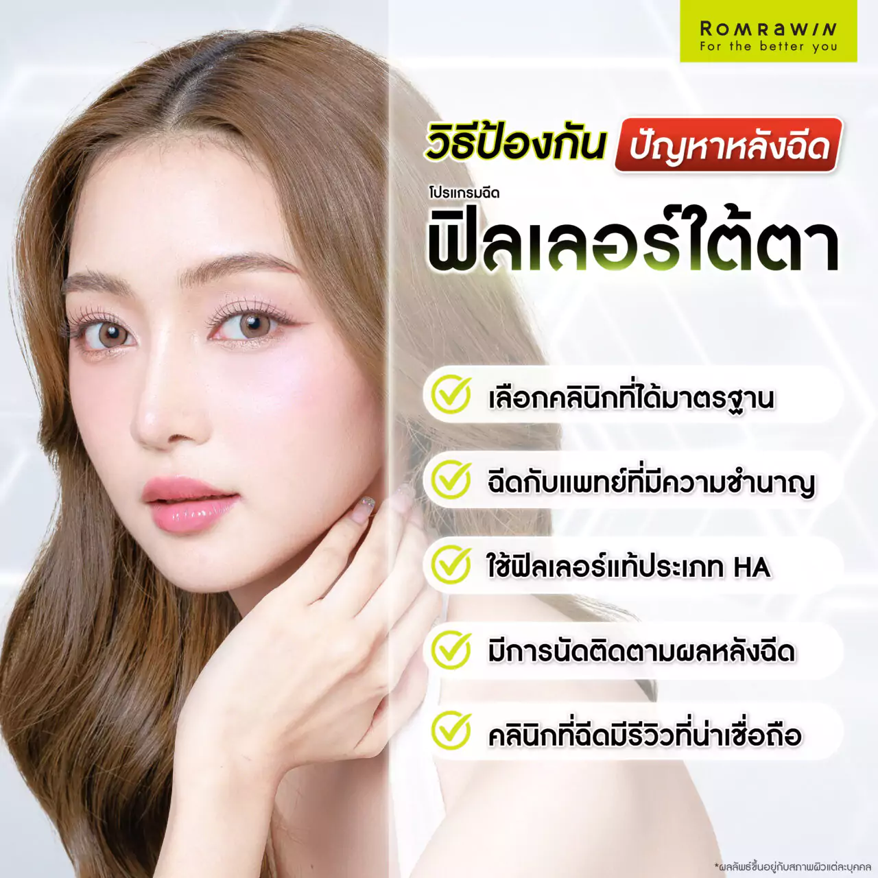 วิธีป้องกันปัญหาหลังฉีดฟิลเลอร์ใต้ตา