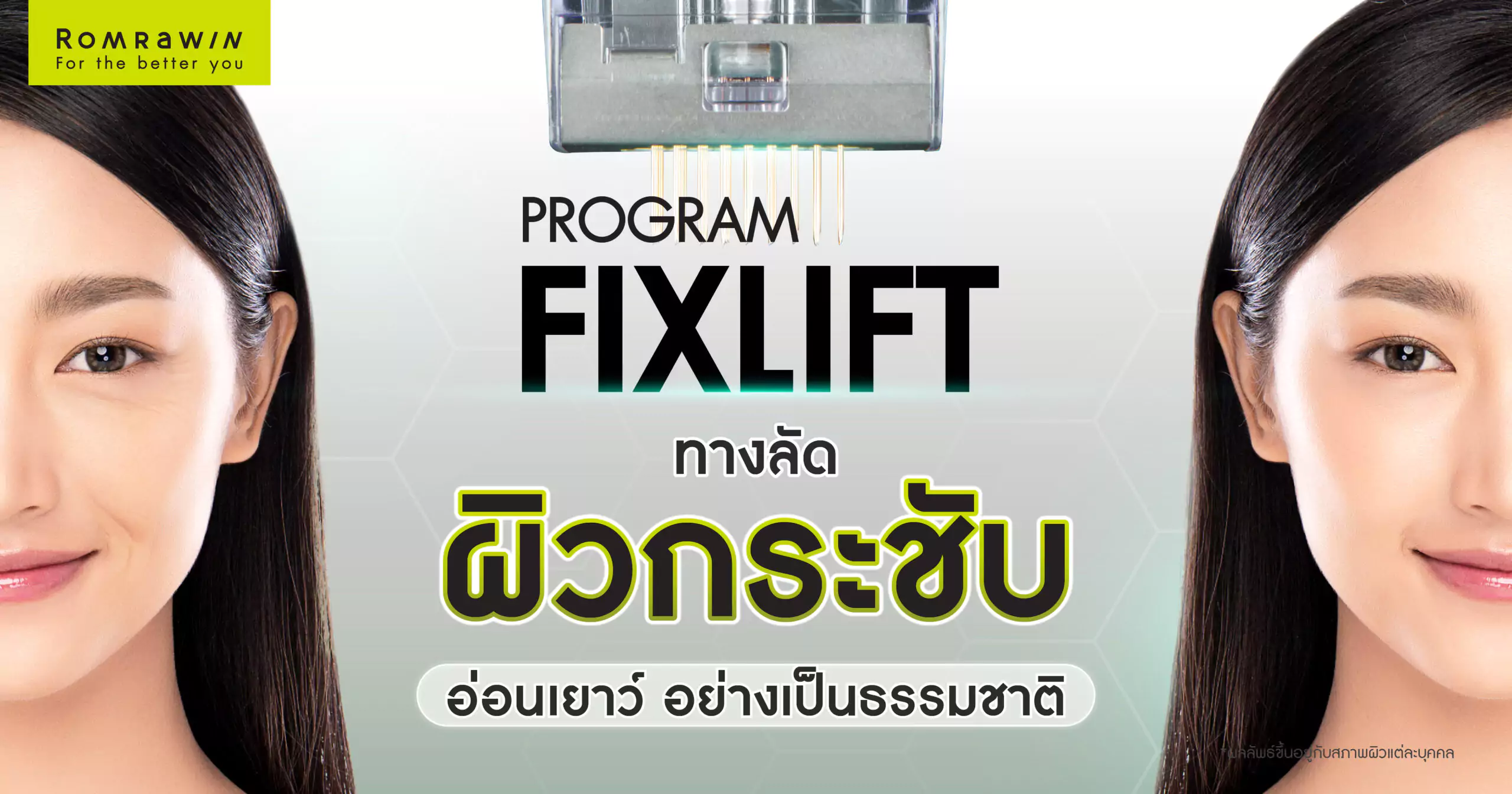 Fix Lift ทางลัดสู่ผิวกระชับ อ่อนเยาว์ในแบบที่คุณต้องการ