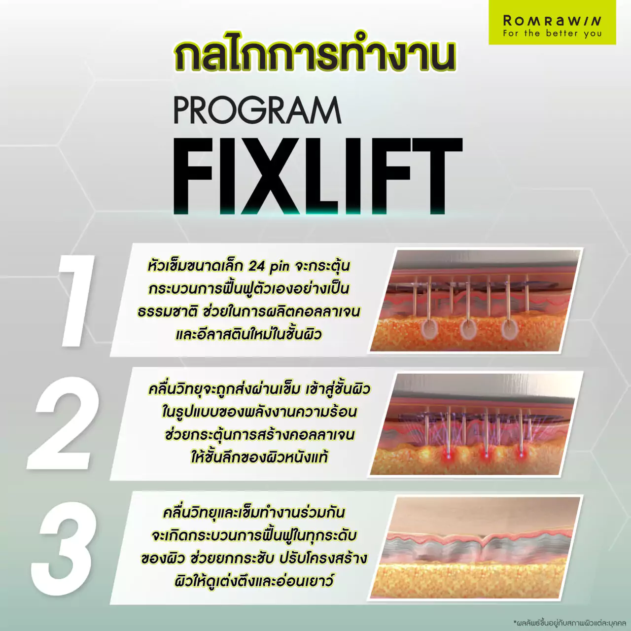 โปรแกรม Fix Lift ทางลัดสู่ผิวกระชับ อ่อนเยาว์ในแบบที่คุณต้องการ 3 หลักการทำงานของโปรแกรม Fix Lift กู้ผิวยับ ยกผิวหย่อน