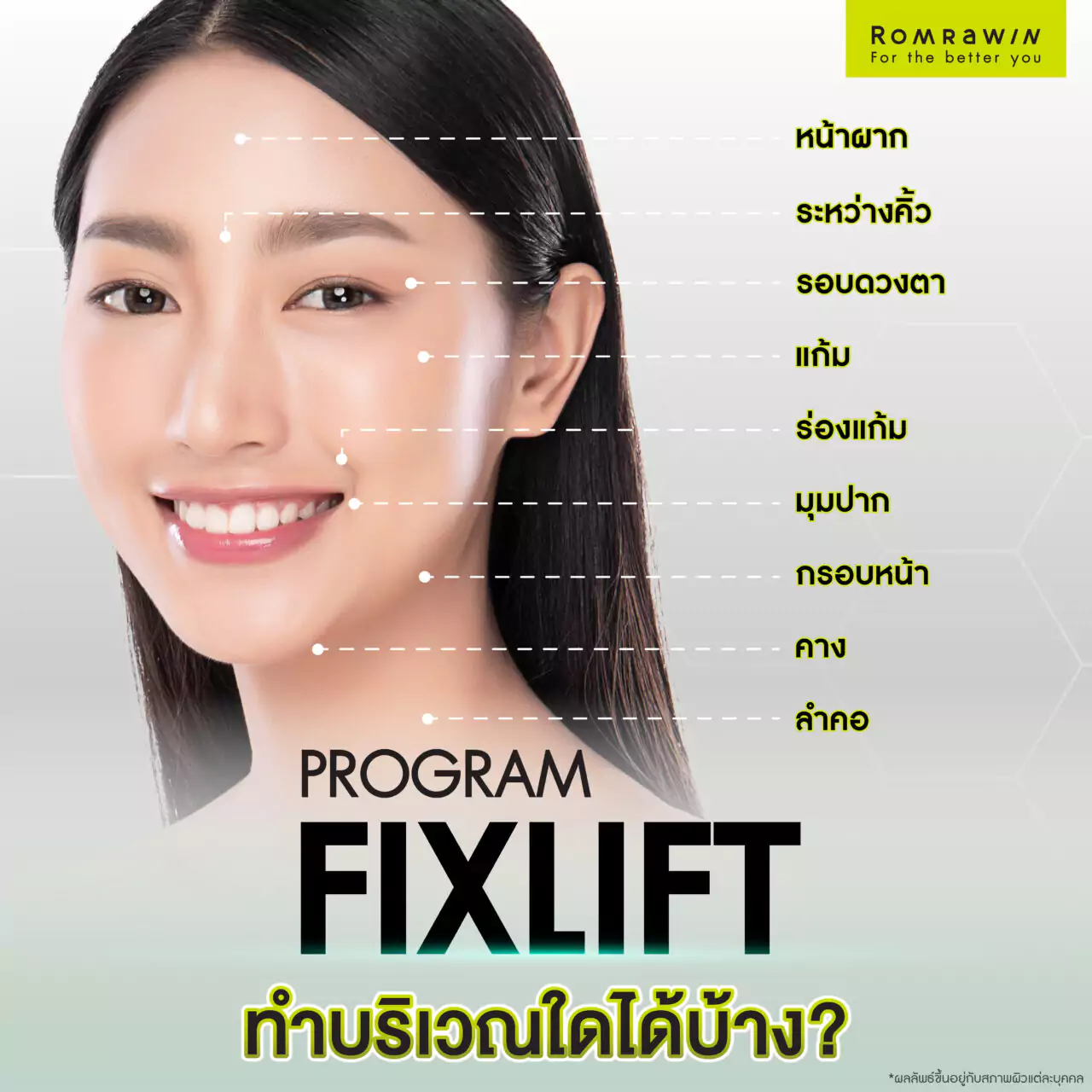 โปรแกรม Fix Lift ทางลัดสู่ผิวกระชับ อ่อนเยาว์ในแบบที่คุณต้องการ 5 โปรแกรม Fix Lift กู้ผิวยับ ยกผิวหย่อน สามารถทำที่บริเวณไหนได้บ้าง?