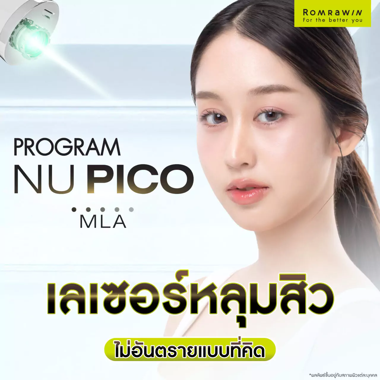 โปรแกรม Nu Pico MLA เลเซอร์หลุมสิวไม่อันตรายแบบที่คิด