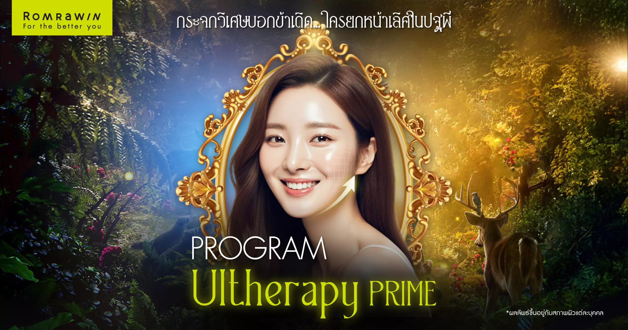 Ultherapy Prime สโนว์ไวท์