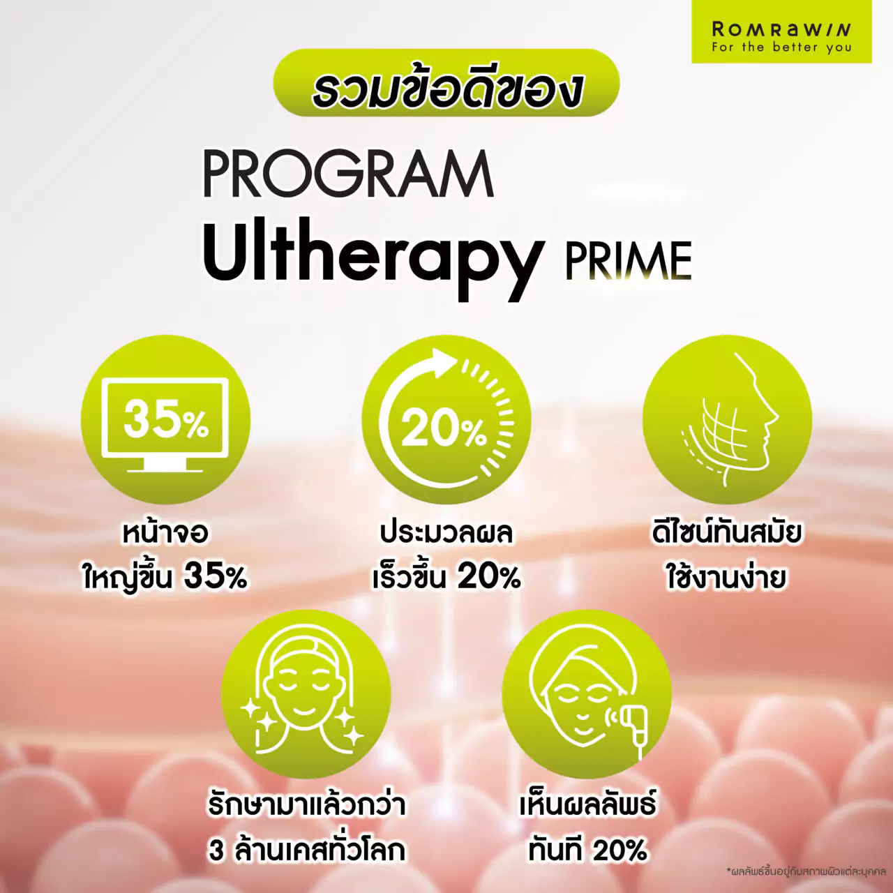 Ultherapy Prime สโนว์ไวท์ 