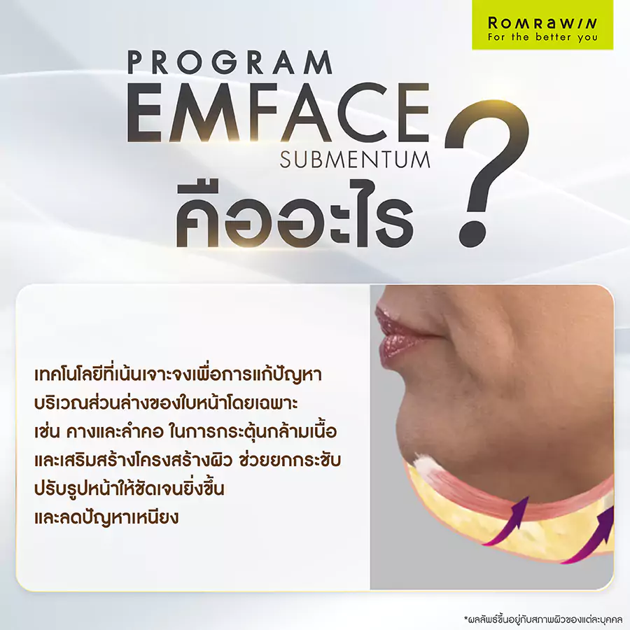 โปรแกรม EMFACE Submentum คืออะไร?