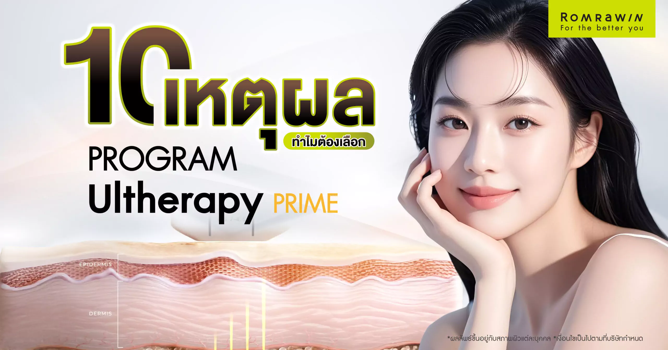 Ultherapy Prime เทคโนโลยียกกระชับ