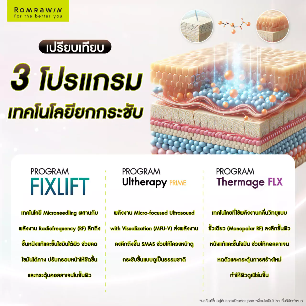 เทคโนโลยียกกระชับไหนเหมาะกับหน้าหย่อนคล้อยมากที่สุด? 3 เปรียบเทียบ Fix Lift, Ulthera Prime และ Thermage FLX แบบไหนเหมาะที่สุด?