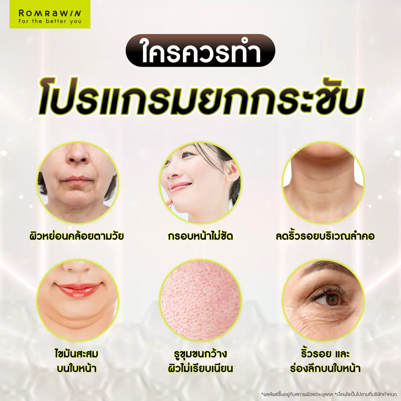 เทคโนโลยียกกระชับไหนเหมาะกับหน้าหย่อนคล้อยมากที่สุด? 6 การทำเทคโนโลยียกกระชับ แก้หน้าหย่อนคล้อย เหมาะกับใครบ้าง?