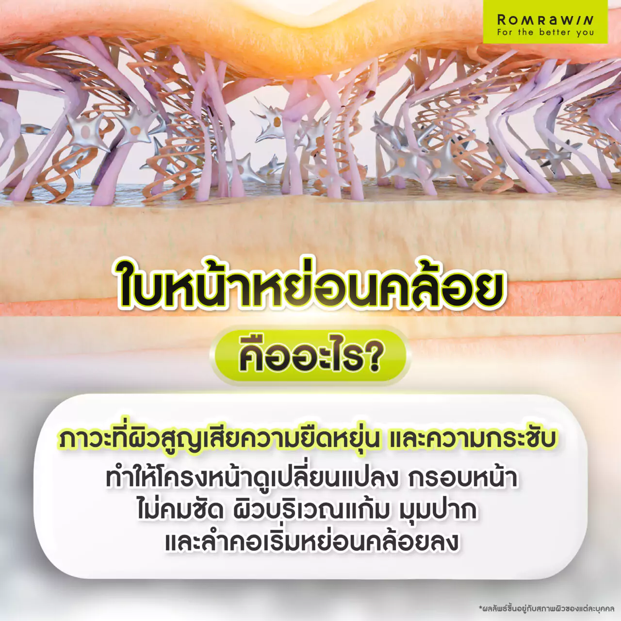 ใบหน้าหย่อนคล้อย ยกกระชับด้วยวิธีไหนดี? รวมวิธียกกระชับใบหน้าหย่อนคล้อยที่ได้ผล! 1 ใบหน้าหย่อนคล้อยคืออะไร?