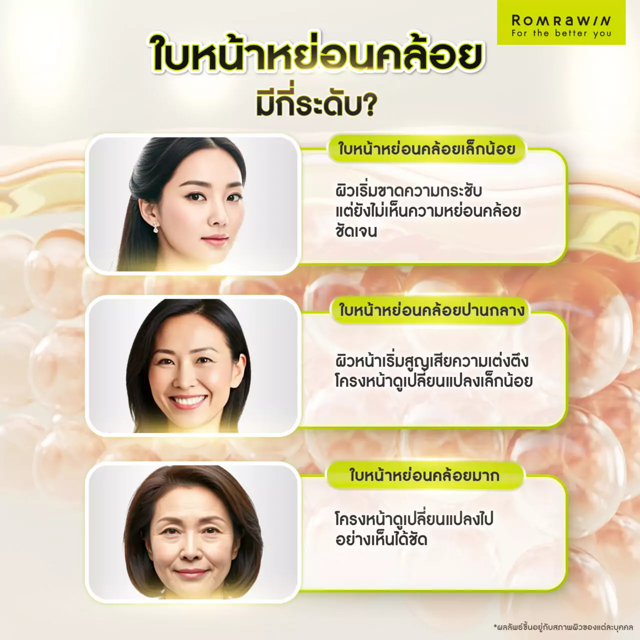 ใบหน้าหย่อนคล้อยมีกี่ระดับ? ควรเลือกใช้วิธีไหน?