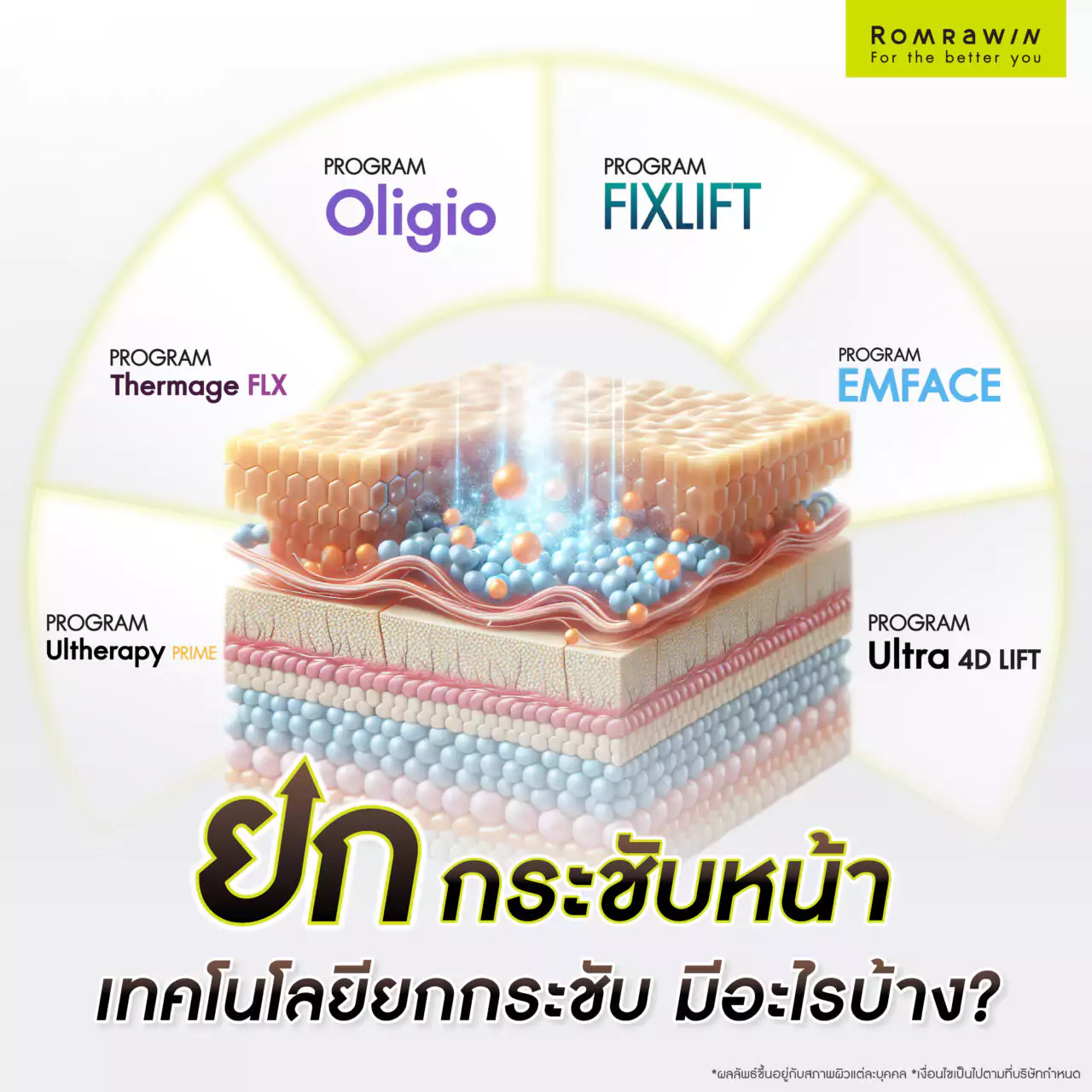 ยกกระชับหน้าด้วยเทคโนโลยียกกระชับ มีอะไรบ้าง?