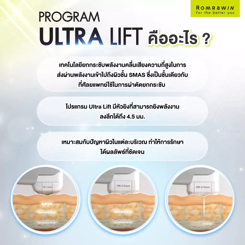 ยกกระชับผิวหน้า Ultra Lift ปรับหน้าเรียว คืออะไร? 