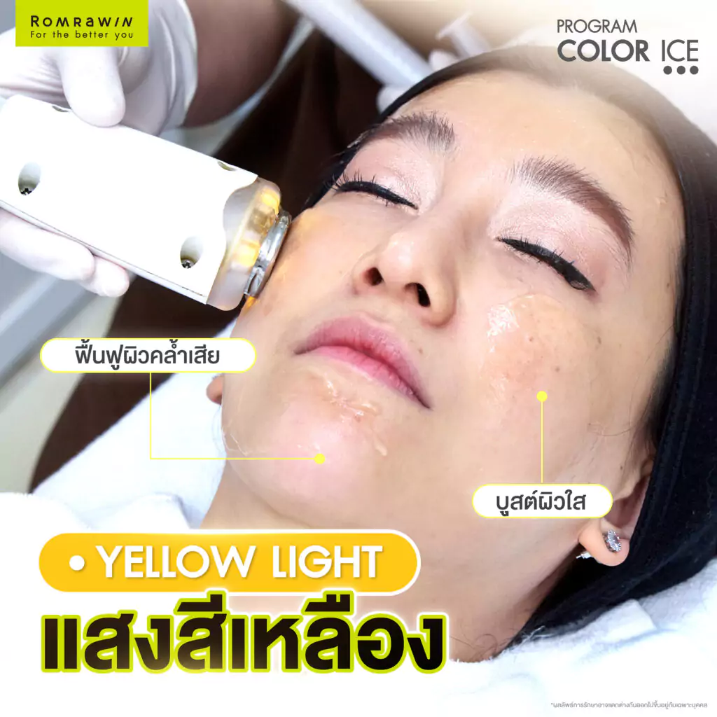 COLOR ICE แสงสีเหลือง