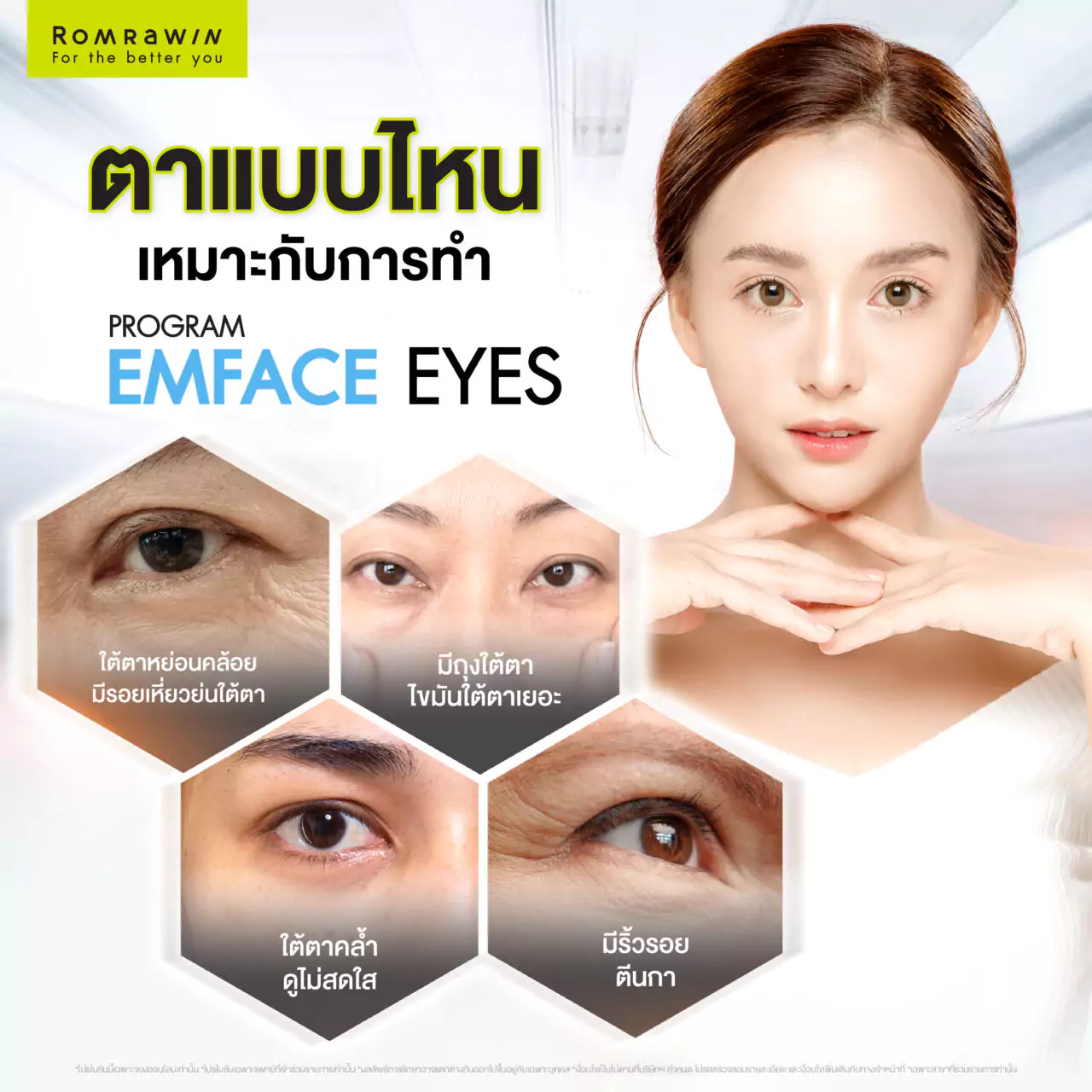Emface Eyes ผสาน 2 เทคโนโลยีเพื่อผิวใต้ตาเฟิร์ม กระจ่างใส ดูอ่อนเยาว์ 4 ปัญหาดวงตาแบบไหนเหมาะกับการทำ Emface Eyes
