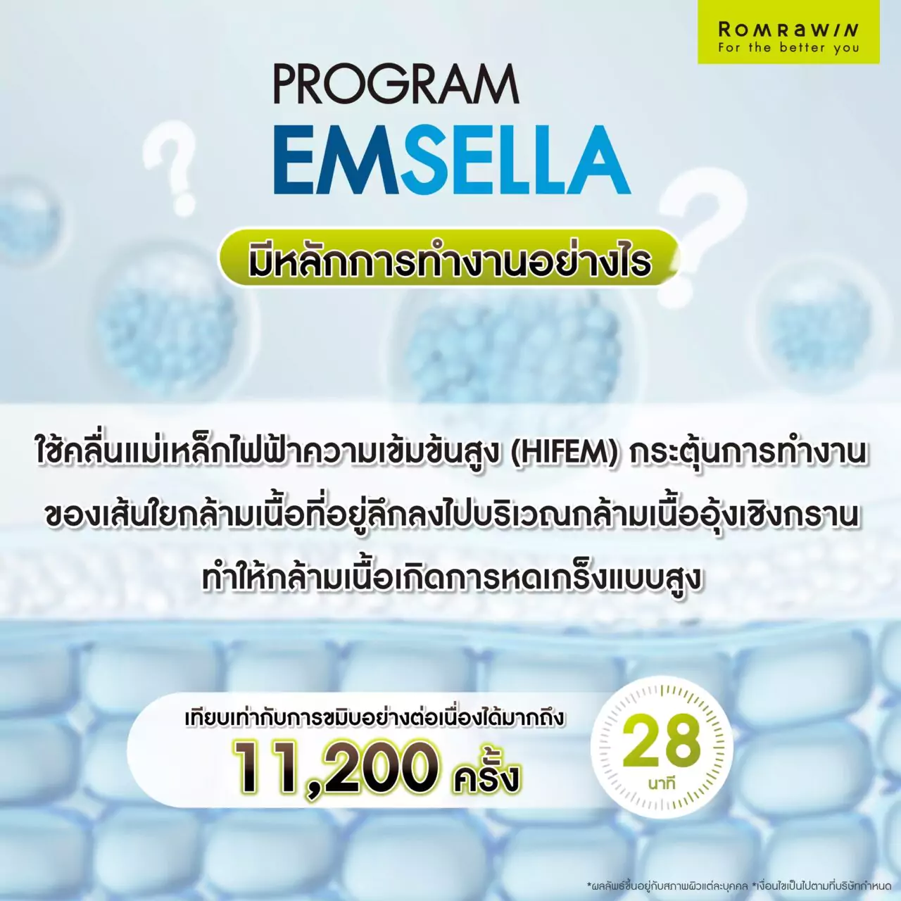 ปัญหาช่องคลอดมีอะไรบ้าง? ฟื้นฟูได้ไม่ต้องผ่าตัดด้วย Emsella เก้าอี้กระชับช่องคลอด 3 Emsella มีหลักการทำงานอย่างไร?