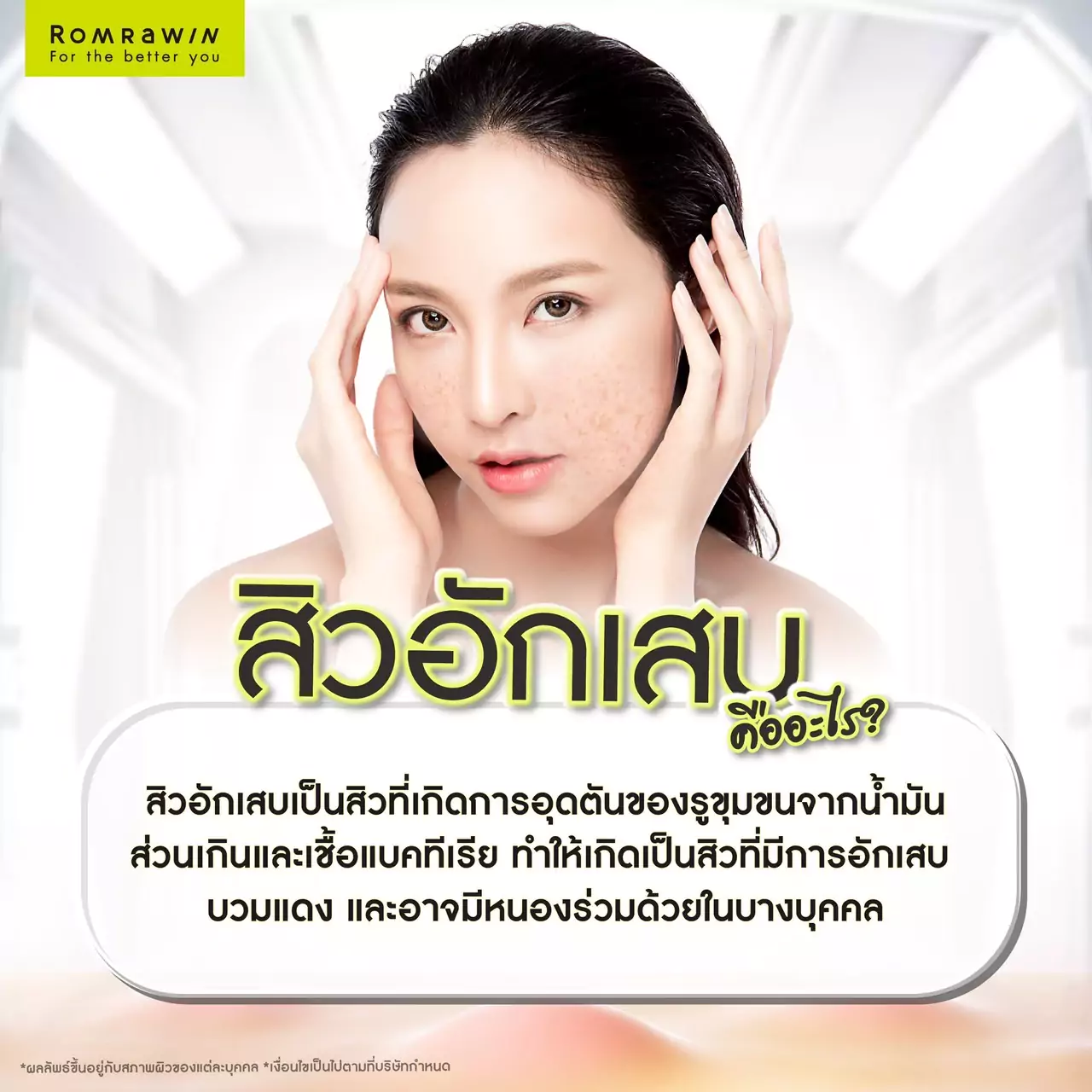 สิวอักเสบเกิดจากอะไร ? รวมคำถามเกี่ยวกับสิวอักเสบที่คุณไม่เคยรู้ 3 สิวอักเสบเกิดจากอะไร ?