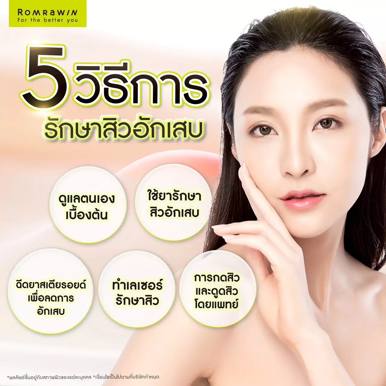สิวอักเสบเกิดจากอะไร ? รวมคำถามเกี่ยวกับสิวอักเสบที่คุณไม่เคยรู้ 5 วิธีการรักษาสิวอักเสบ