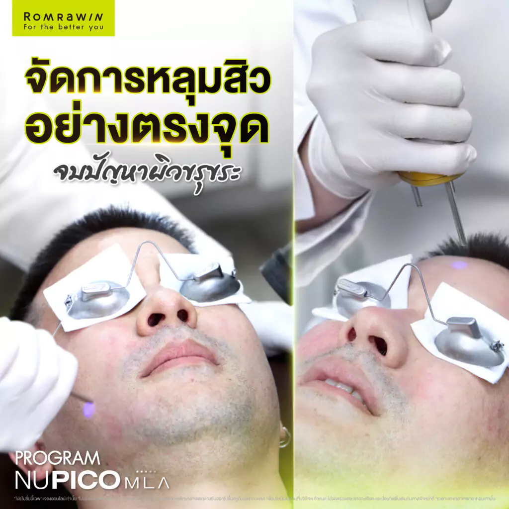 NU PICO MLA 