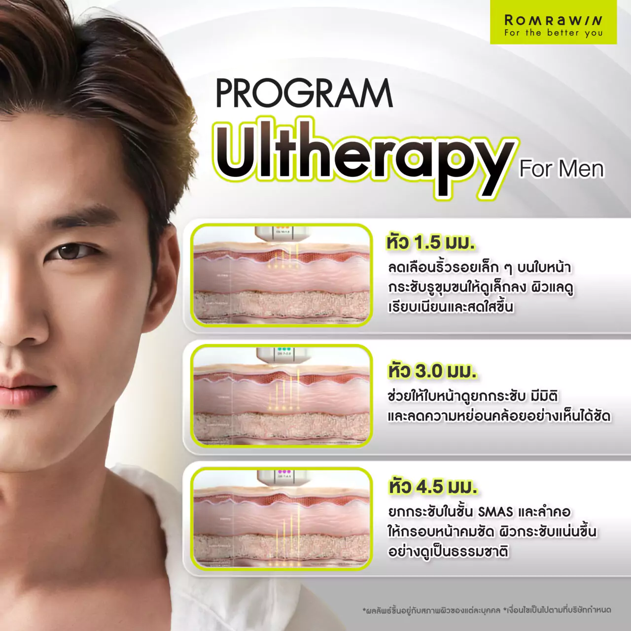 Ultherapy for Men ยกกระชับใบหน้าสำหรับคุณผู้ชาย 3 ยกกระชับผิว Ultherapy For Men คืออะไร?