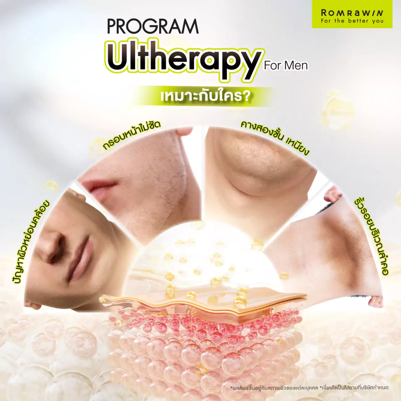 Ultherapy for Men ยกกระชับใบหน้าสำหรับคุณผู้ชาย 5 ยกกระชับผิว Ultherapy For Men เหมาะกับใครบ้าง?