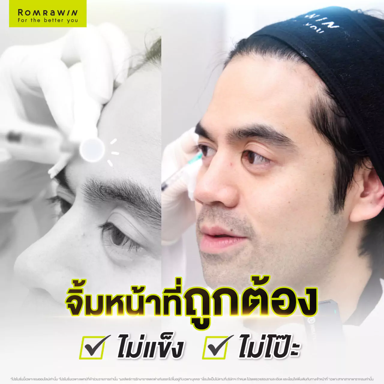 เก็บริ้วรอย ต้องจัดโปรแกรมฉีดโบ ที่หนึ่งในใจคุณแอลลี่ สไตล์ลิสชื่อดัง 3 แอลลี่ สไตล์ลิสชื่อดัง
